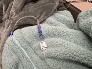 Infusion Day 2