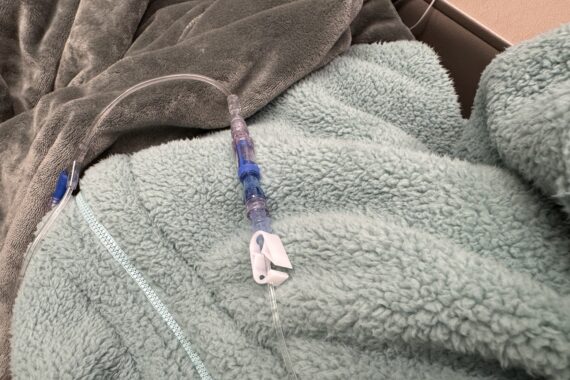 Infusion Day 2